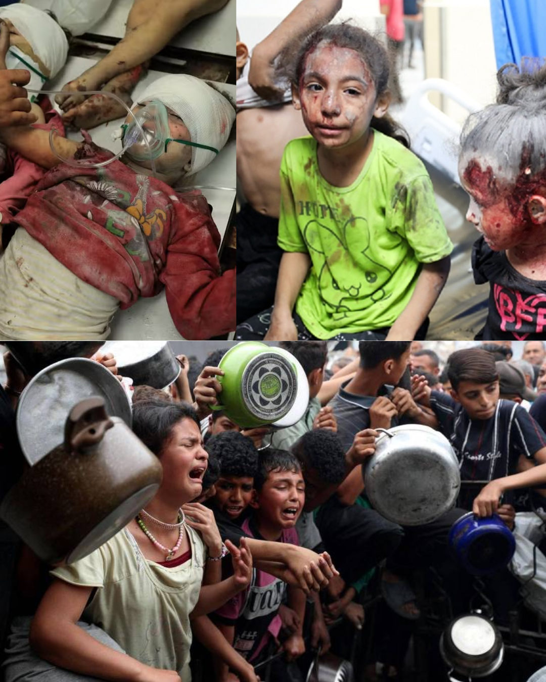 Children Left Alone After the War in Israel — Many Are Injured and Going Hungry